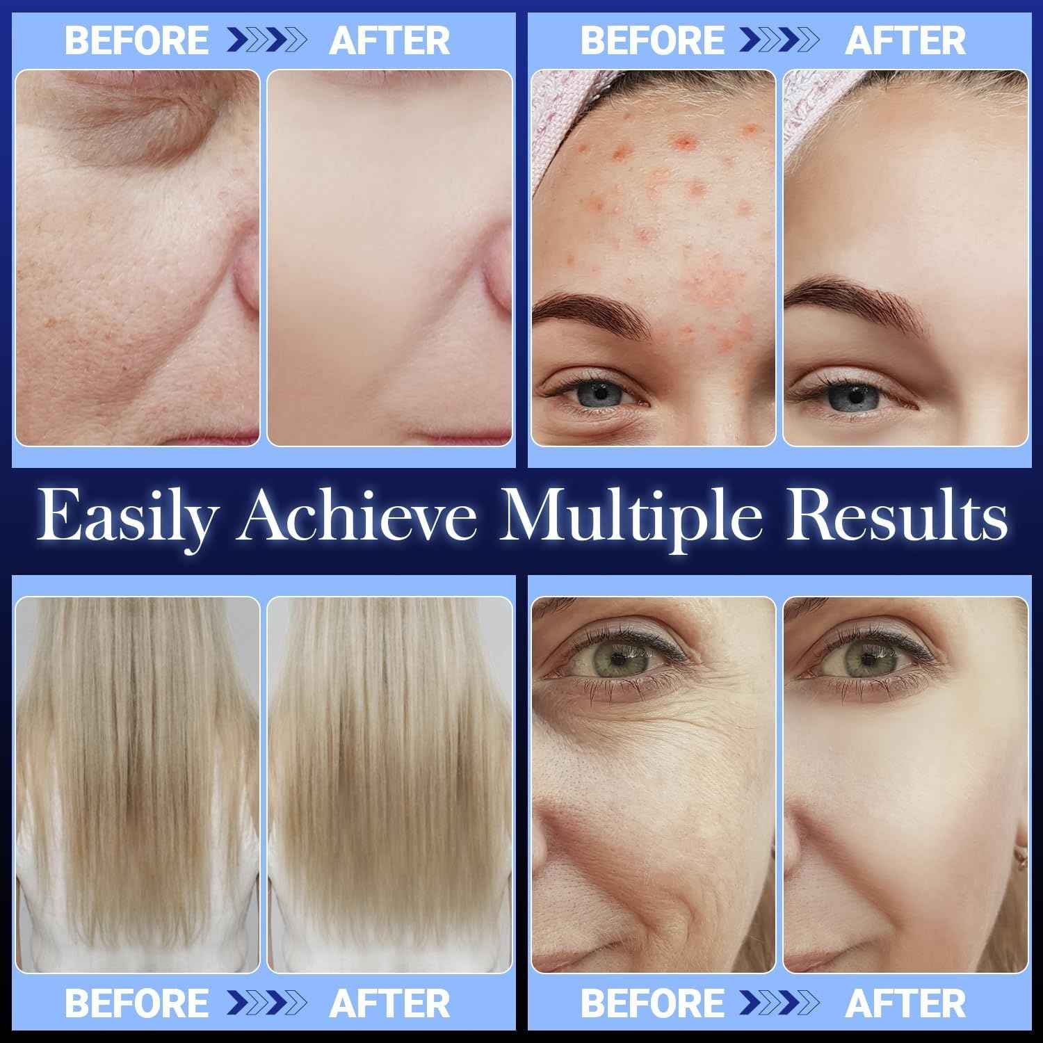 High Frequency Wand 'C Violet Portable Skin Therapy Machine for Anti-Aging - Skin Tightening - Wrinkle Reducing - Dark Circles - 4 in 1