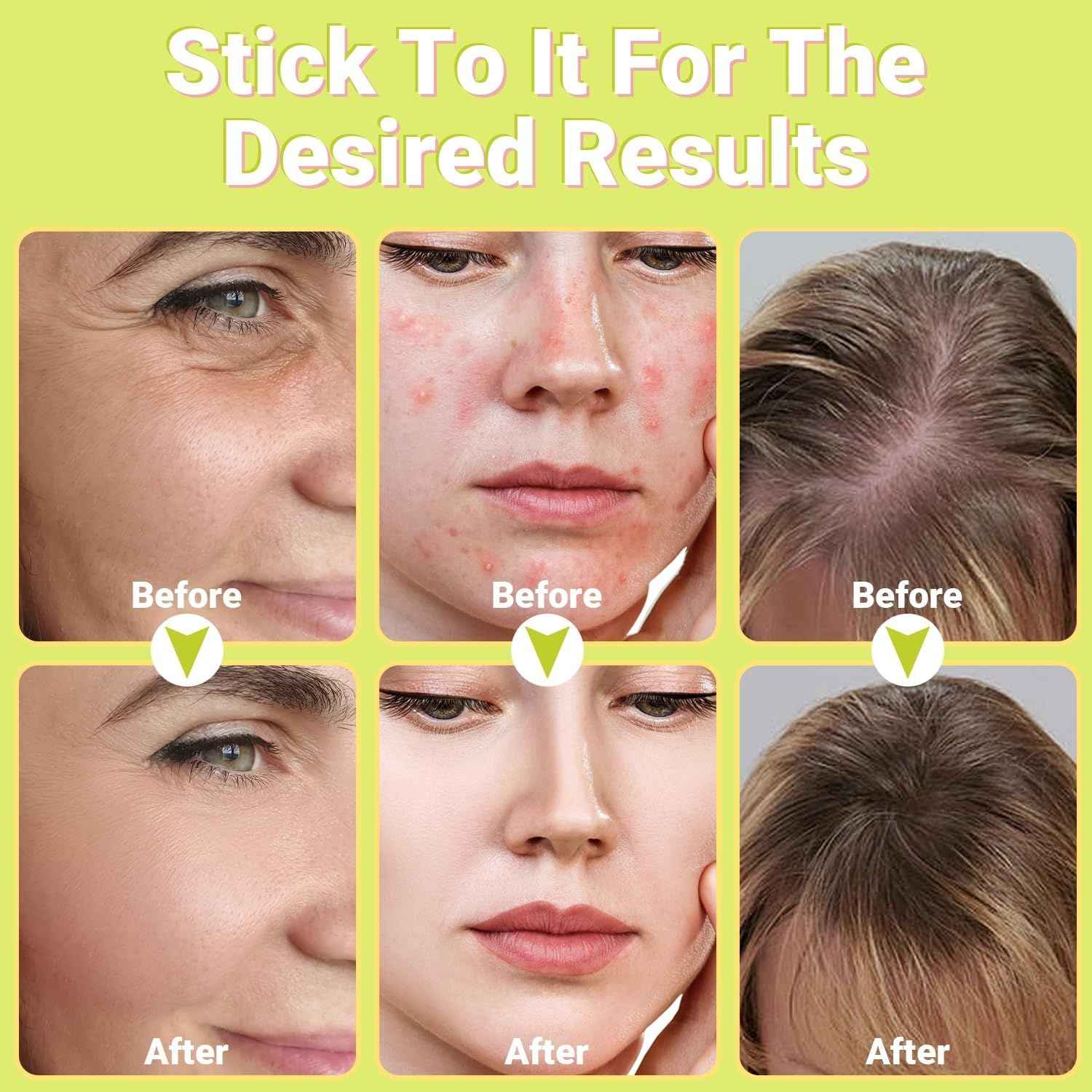 High Frequency Wand 'C Violet Portable Skin Therapy Machine for Anti-Aging - Skin Tightening - Wrinkle Reducing - Dark Circles - 4 in 1