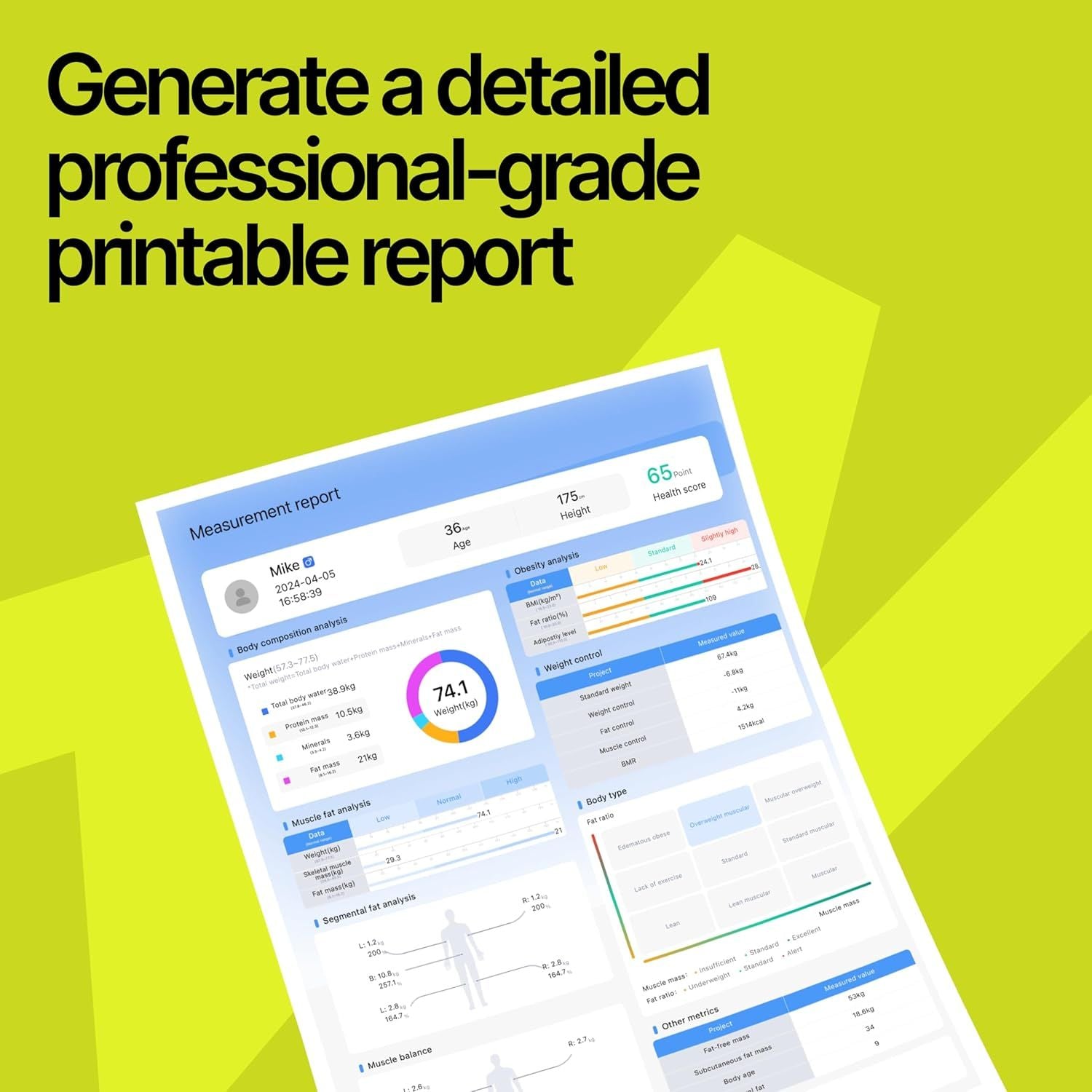 25 Metrics EziGo White Digital Bathroom Smart Scale with BMI, Body Fat, Muscle Mass, Bluetooth, Apple Health Compatible Scales, Digital Weight Composition Scale & Body Fat Mass, Up to 400lb/180 kg - JM Variety Store